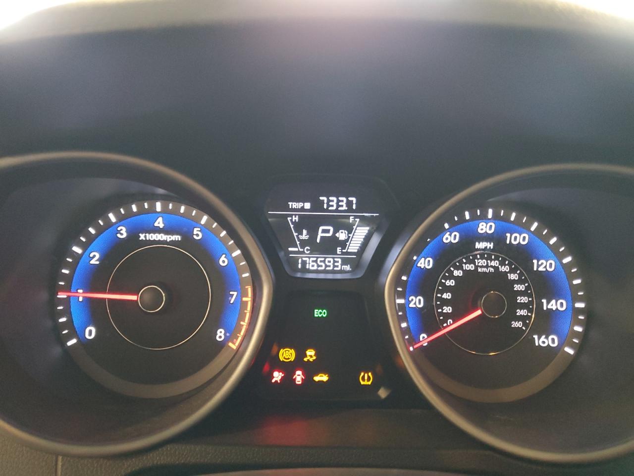 Hyundai ELANTRA Se Image 6